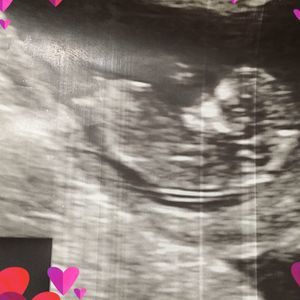 Meet your Posher, Allyson